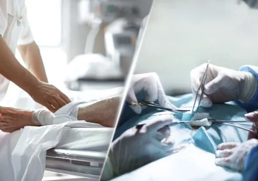 angiologia- cirurgia-vascular
